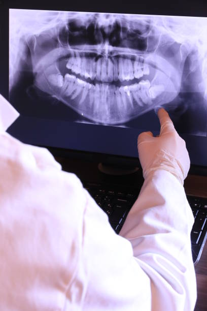 Best Emergency Treatment for Dental Infections or Abscesses in Plano, KY